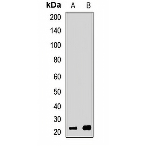 EXOSC1 Rabbit Polyclonal Antibody