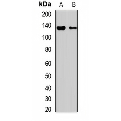 DIAPH3 Rabbit Polyclonal Antibody