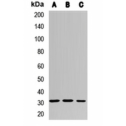 MMACHC Rabbit Polyclonal Antibody