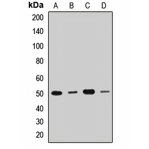 DDX47 Rabbit Polyclonal Antibody