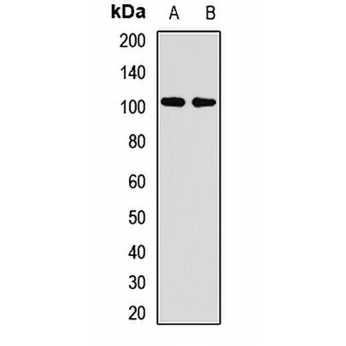 ZC3H14 Rabbit Polyclonal Antibody