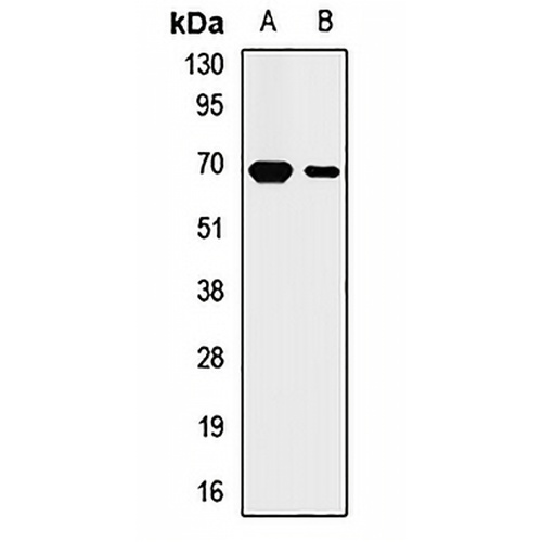 Cytokeratin 2 Rabbit Polyclonal Antibody