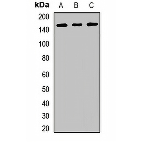 RBM6 Rabbit Polyclonal Antibody