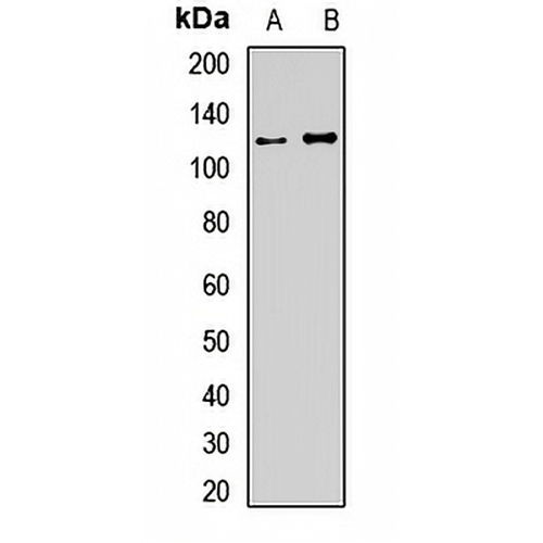 USP28 Rabbit Polyclonal Antibody