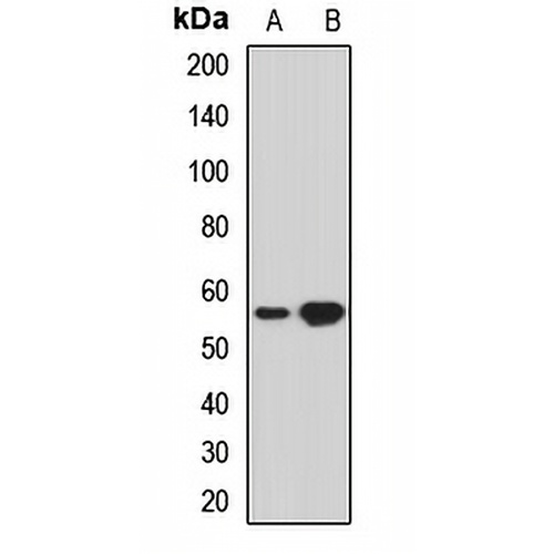 THUMPD3 Rabbit Polyclonal Antibody