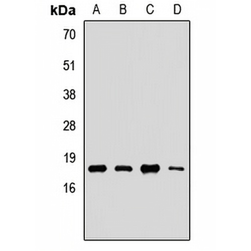 UBE2G2 Rabbit Polyclonal Antibody
