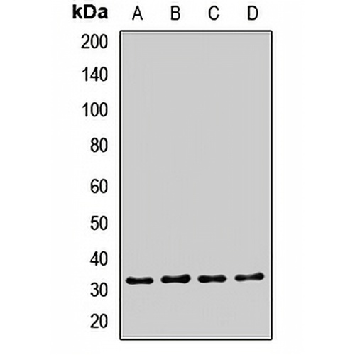 EXOSC2 Rabbit Polyclonal Antibody