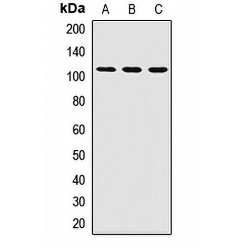 PEX6 Rabbit Polyclonal Antibody