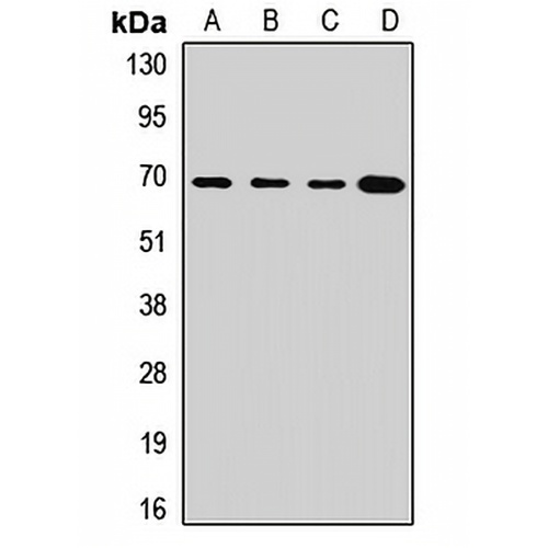 P2RX7 Rabbit Polyclonal Antibody