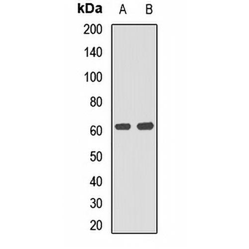 P4HA1 Rabbit Polyclonal Antibody
