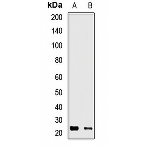 RAB13 Rabbit Polyclonal Antibody