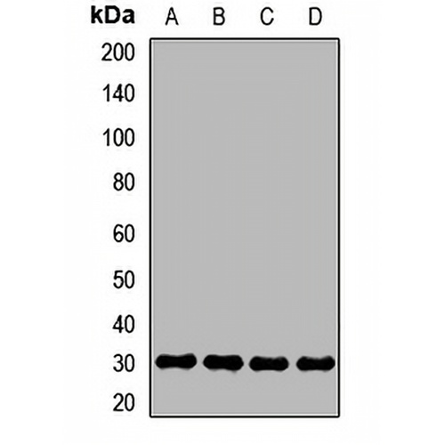 SR- beta Rabbit Polyclonal Antibody