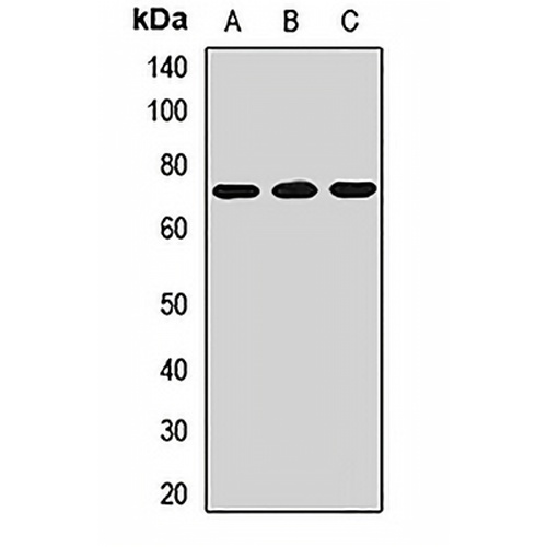 ACBD5 Rabbit Polyclonal Antibody