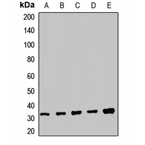 TRMT61A Rabbit Polyclonal Antibody