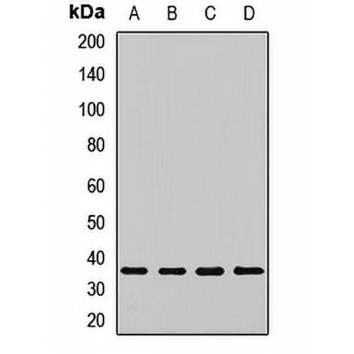 PSMD14 Rabbit Polyclonal Antibody
