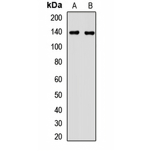 MTMR3 Rabbit Polyclonal Antibody