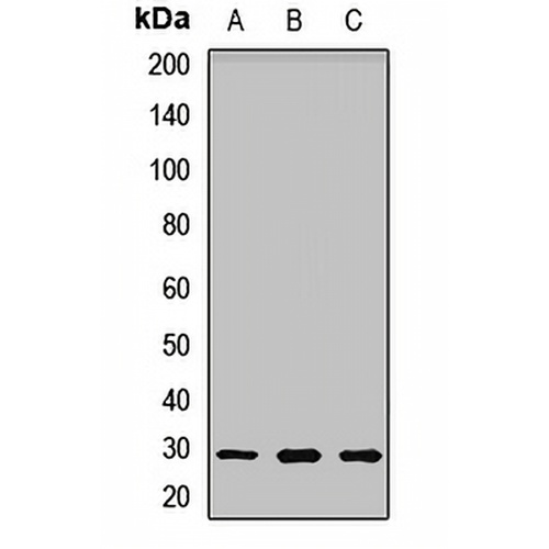 UCK2 Rabbit Polyclonal Antibody