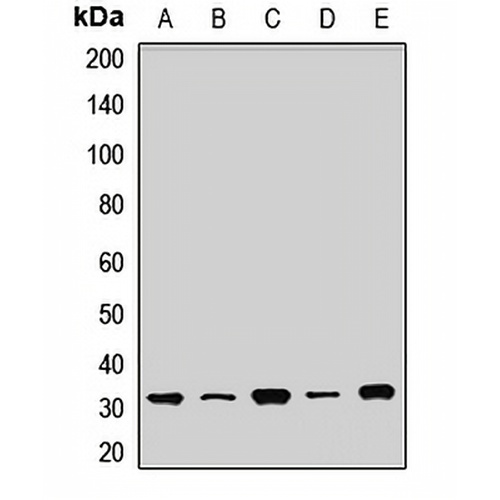 SDHB Rabbit Polyclonal Antibody