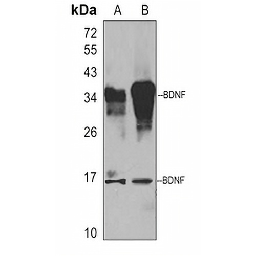 BDNF Rabbit Polyclonal Antibody