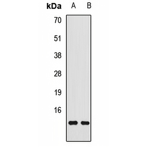 Transthyretin Rabbit Polyclonal Antibody