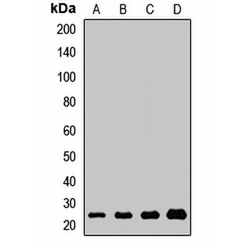ICT1 Rabbit Polyclonal Antibody