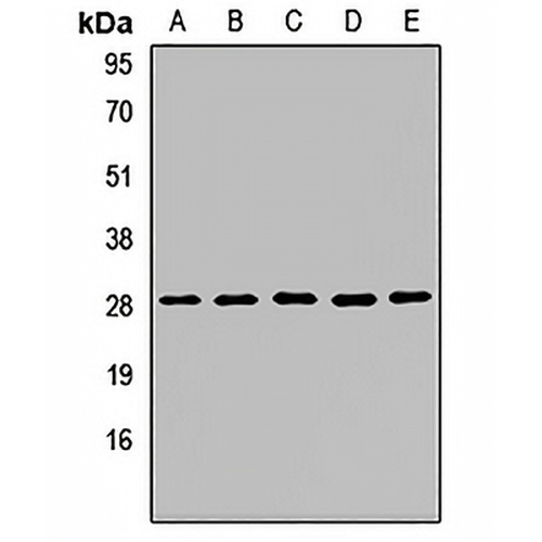 OCIAD1 Rabbit Polyclonal Antibody