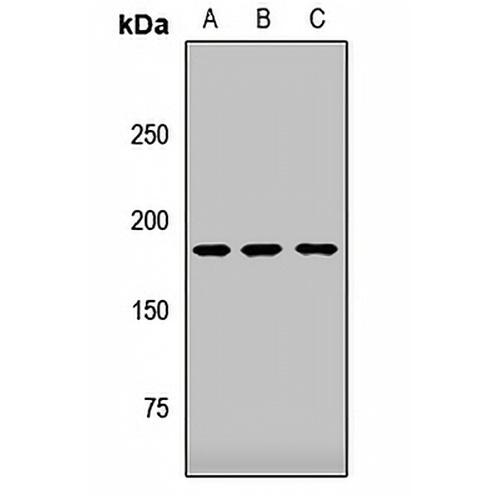 ZCCHC11 Rabbit Polyclonal Antibody