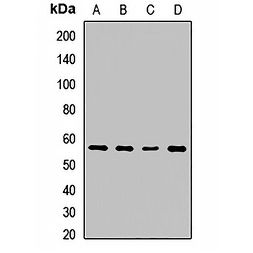 SPTLC2 Rabbit Polyclonal Antibody