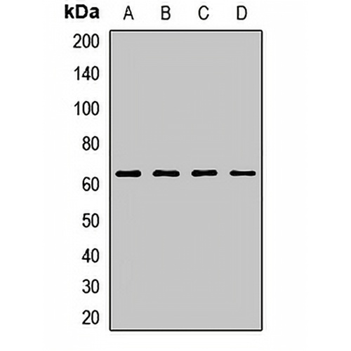 ITPRIP Rabbit Polyclonal Antibody