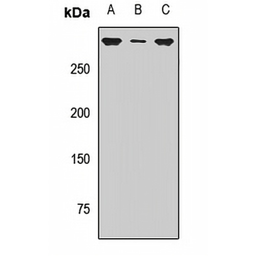 SETD2 Rabbit Polyclonal Antibody