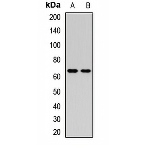 GLMN Rabbit Polyclonal Antibody