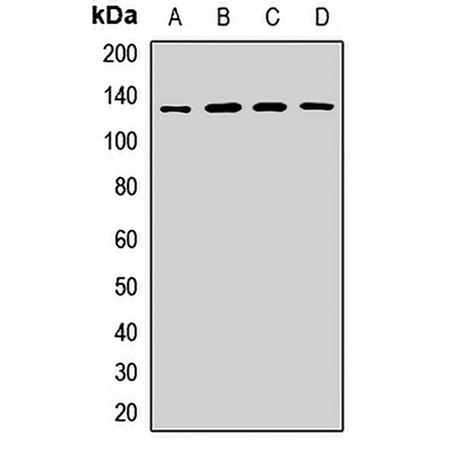 HIP1R Rabbit Polyclonal Antibody