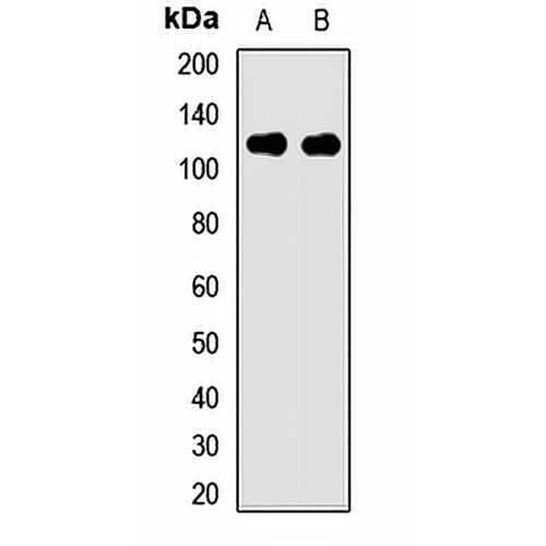 PIBF Rabbit Polyclonal Antibody