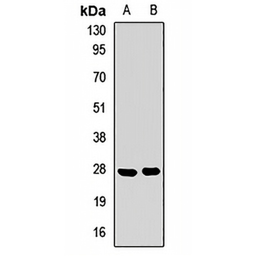 SPRR3 Rabbit Polyclonal Antibody