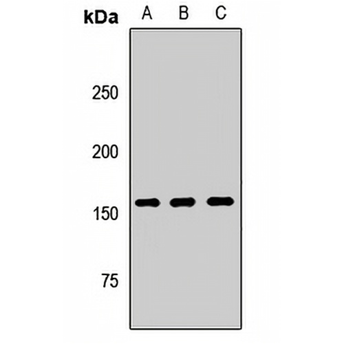 GIGYF2 Rabbit Polyclonal Antibody