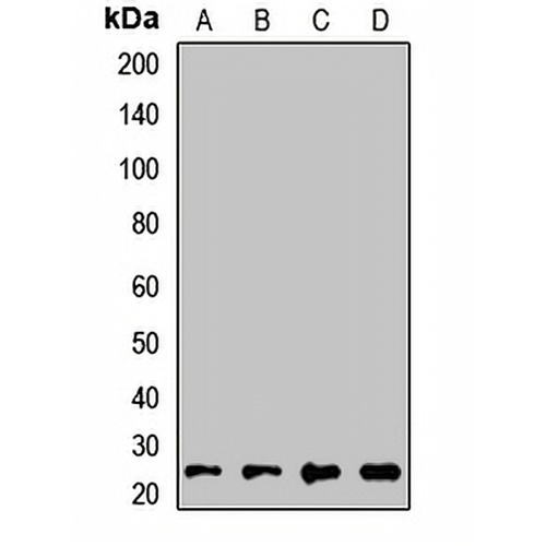 RAB21 Rabbit Polyclonal Antibody