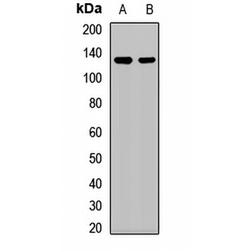 SART3 Rabbit Polyclonal Antibody