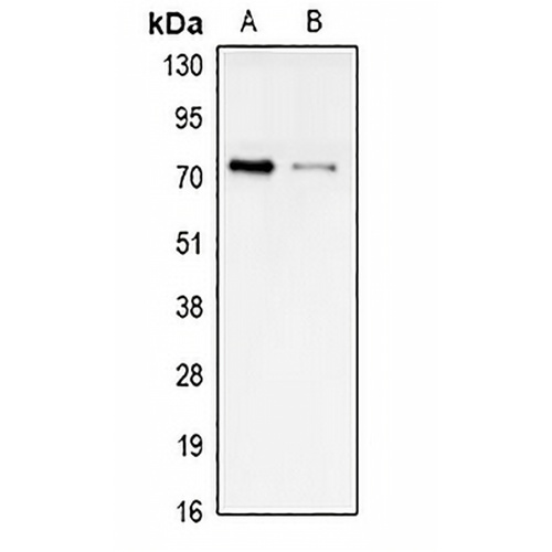 STRA6 Rabbit Polyclonal Antibody