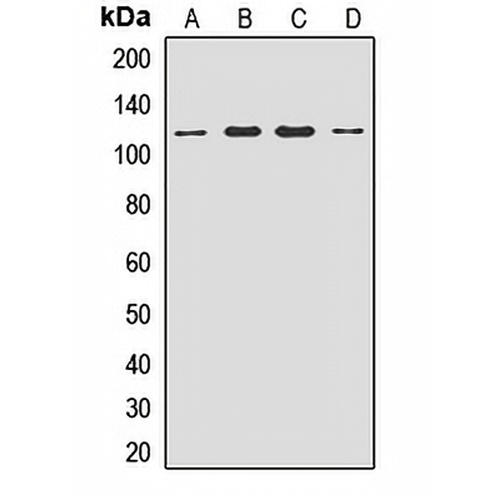 ACAP2 Rabbit Polyclonal Antibody
