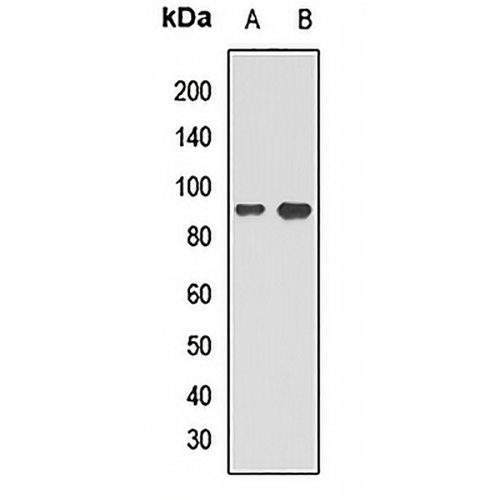 CDT2 Rabbit Polyclonal Antibody