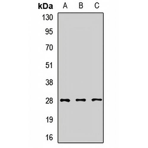SNRPA1 Rabbit Polyclonal Antibody