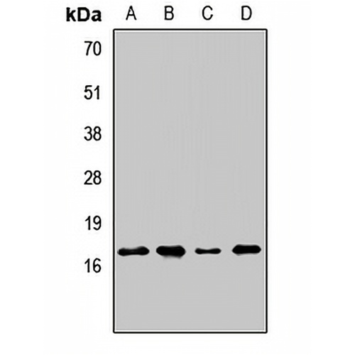 AGTRAP Rabbit Polyclonal Antibody