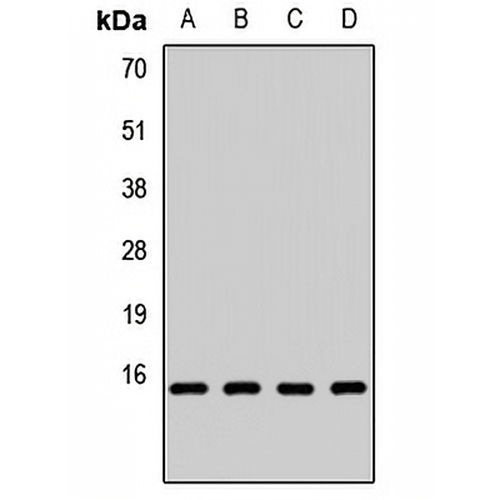 FAU Rabbit Polyclonal Antibody