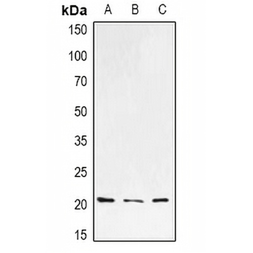 H-Ras Rabbit Polyclonal Antibody