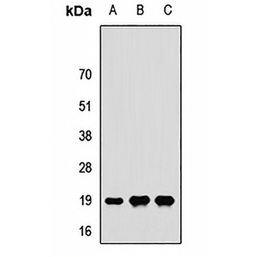 RPS24 Rabbit Polyclonal Antibody