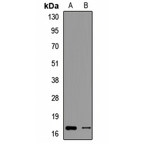PFDN2 Rabbit Polyclonal Antibody
