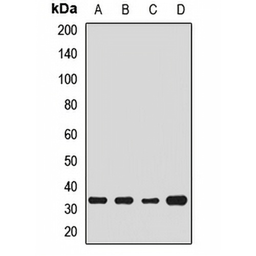 TRAX Rabbit Polyclonal Antibody