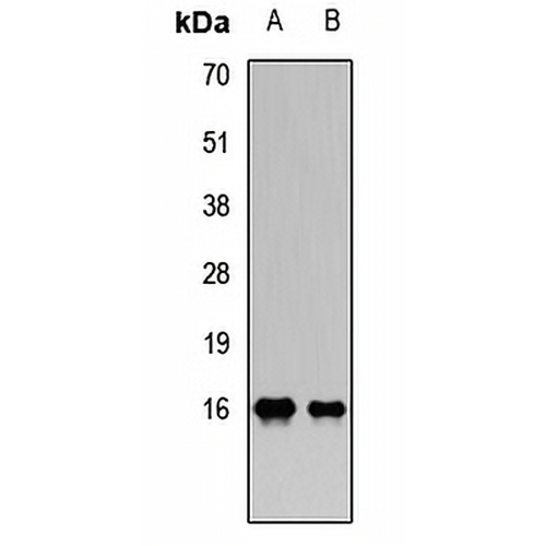 PLA2G2A Rabbit Polyclonal Antibody