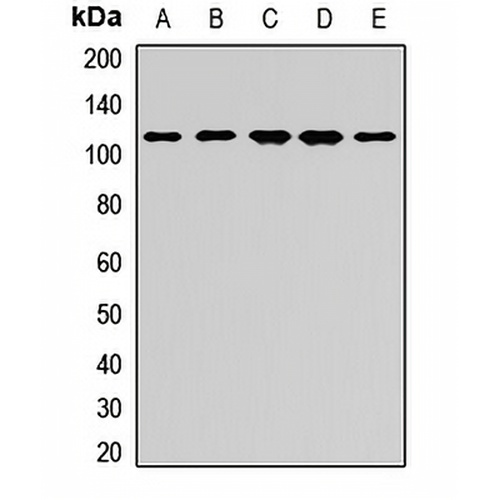 Sec8 Rabbit Polyclonal Antibody