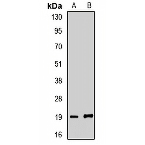 Gemin6 Rabbit Polyclonal Antibody